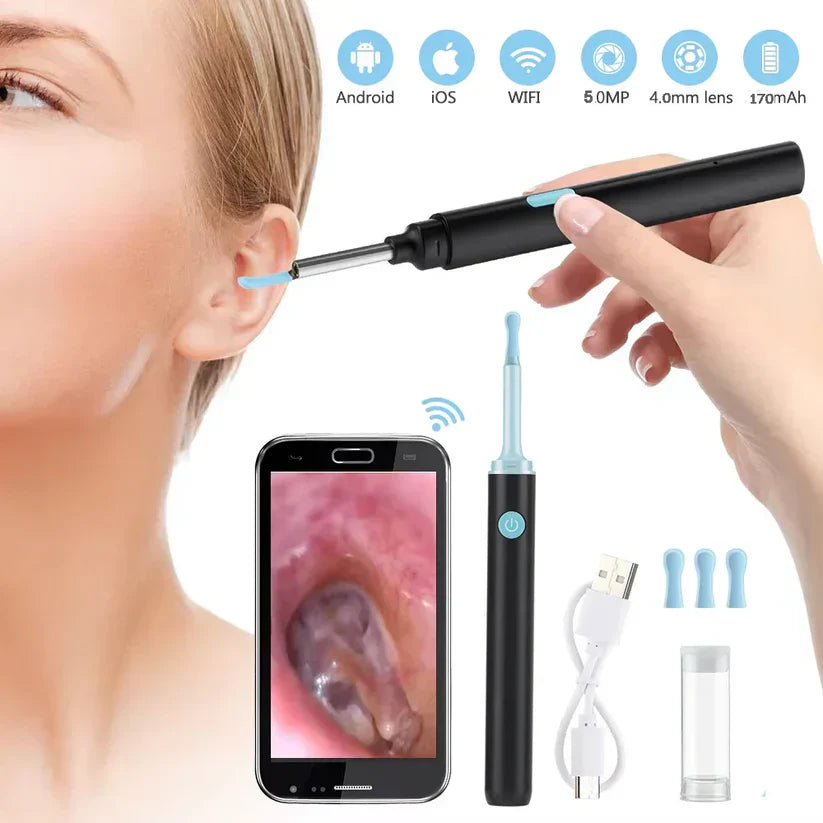 Otocam™ Limpieza de Oídos Inteligente